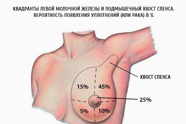 Vasemman rinnan kvadrantit ja rintakehän kynnet.  Sinettien (tai syöpä) todennäköisyys%