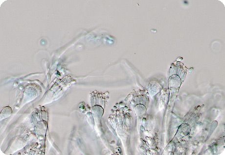 Yksi Aspergillus-suvun sieni 